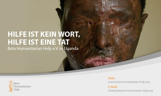 beta-humanitarian-help-e-v-in-uganda-hilfe-ist-kein-wort-hilfe-ist-eine-tat